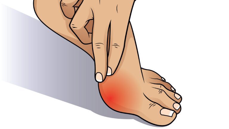 How can orthotics help my bunions?