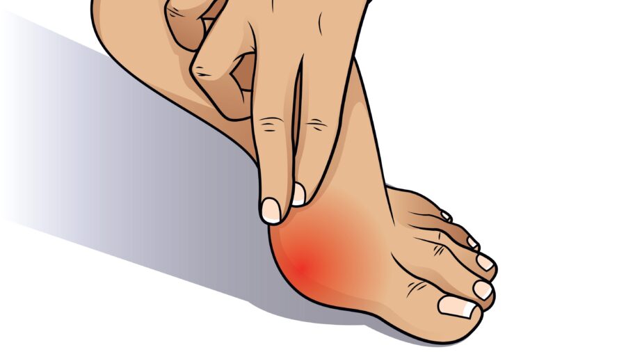 How can orthotics help my bunions?
