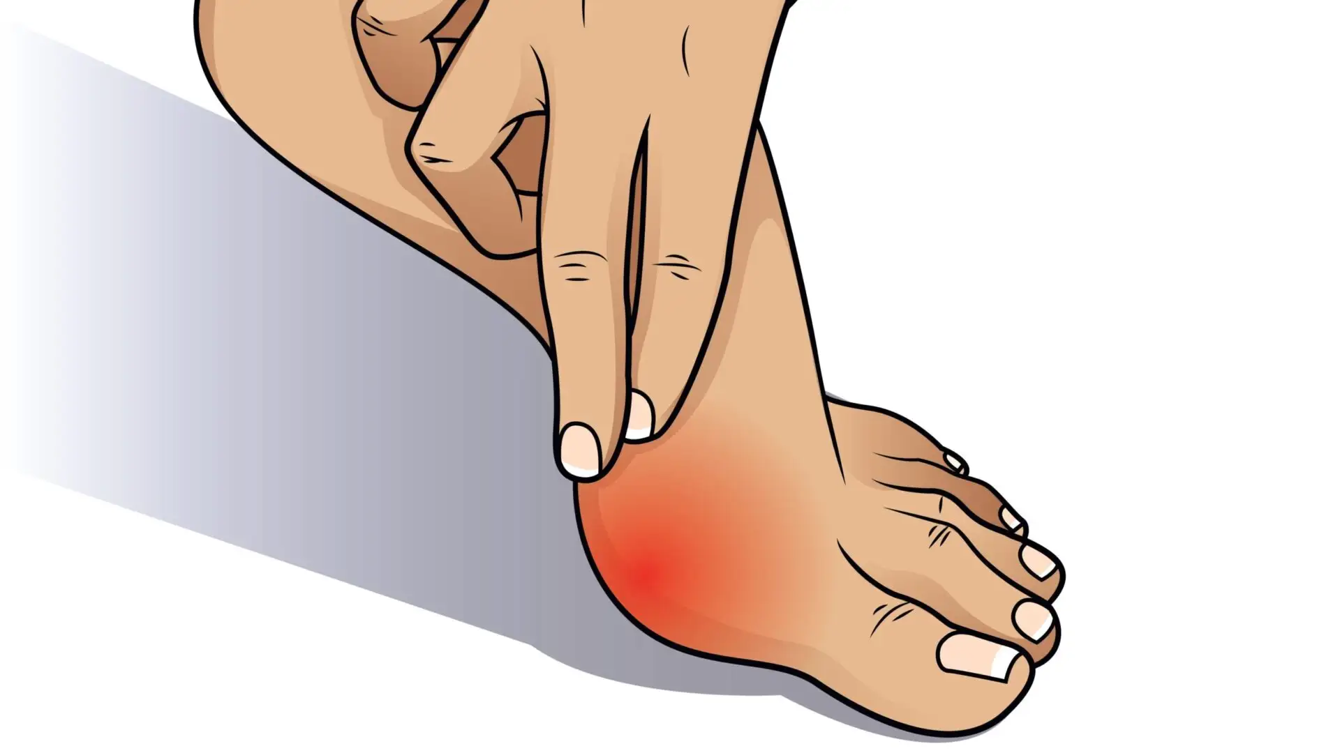How can orthotics help my bunions? PiedRéseau