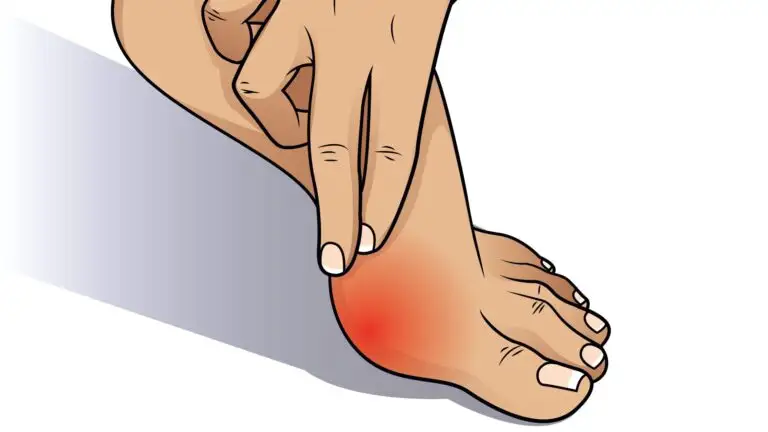 Image de :How can orthotics help my bunions?
