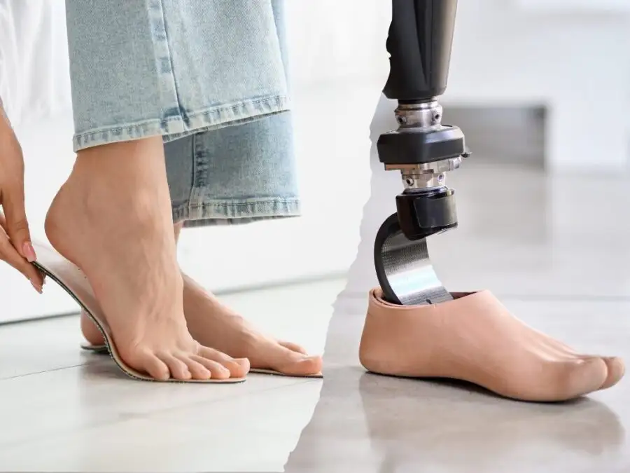 Image de :Orthèse plantaire et prothèse de pied