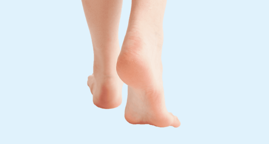 Image de :Les douleurs et traitements du pied creux