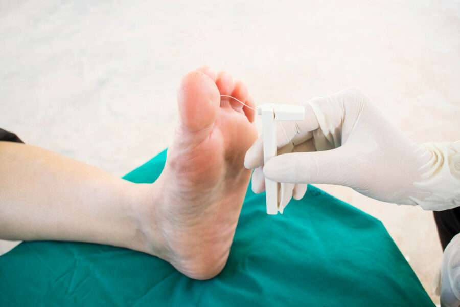 Image de :Le pied diabétique : qu’est-ce que c’est et comment le traiter ?