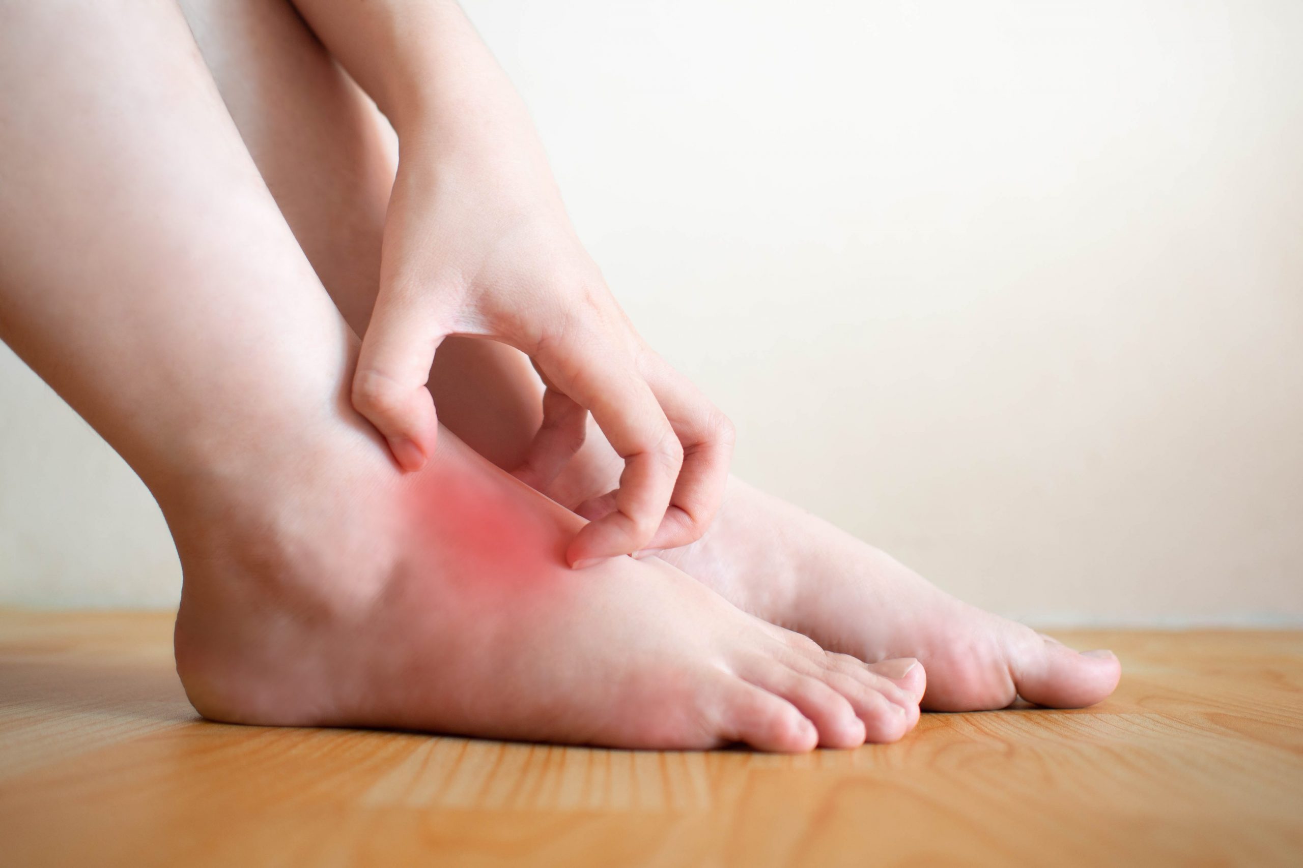 5 conseils pour prévenir l’eczéma du pied