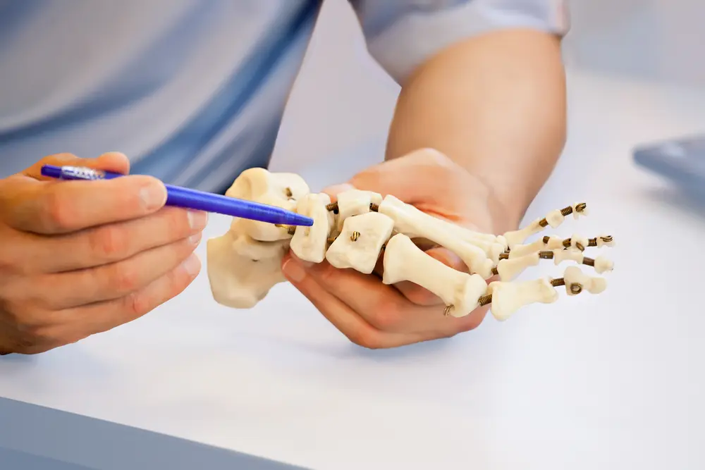 Image de :L’arthrose ou arthrite du pied