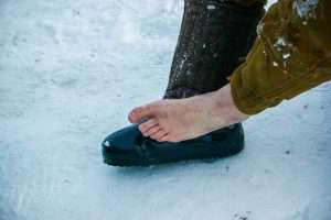 Image de :Treating frostbite on the feet and toes