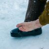 Treating frostbite on the feet and toes