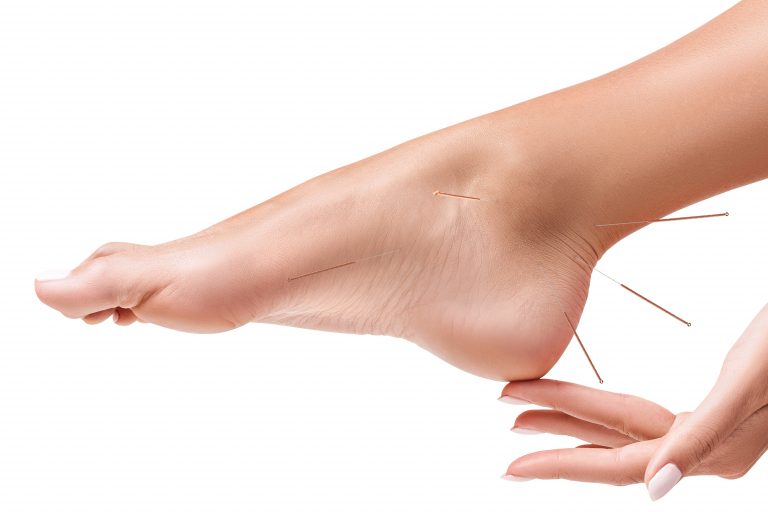 Everything you need to know about foot acupuncture