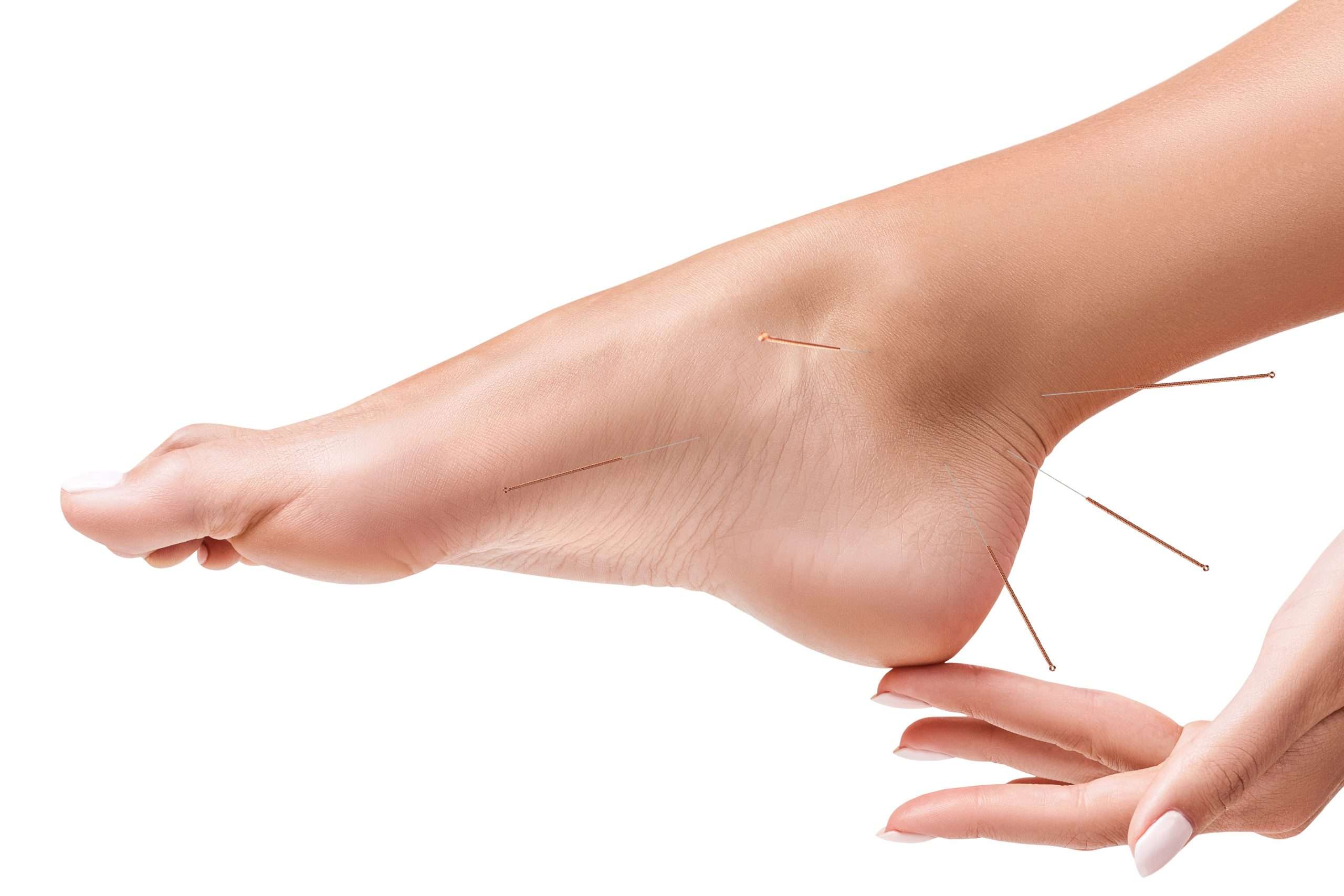 Anti Swelling Anklet-Slip On Pain Relief-Balance-Menopause-Sleep –  Acupressure Bracelets