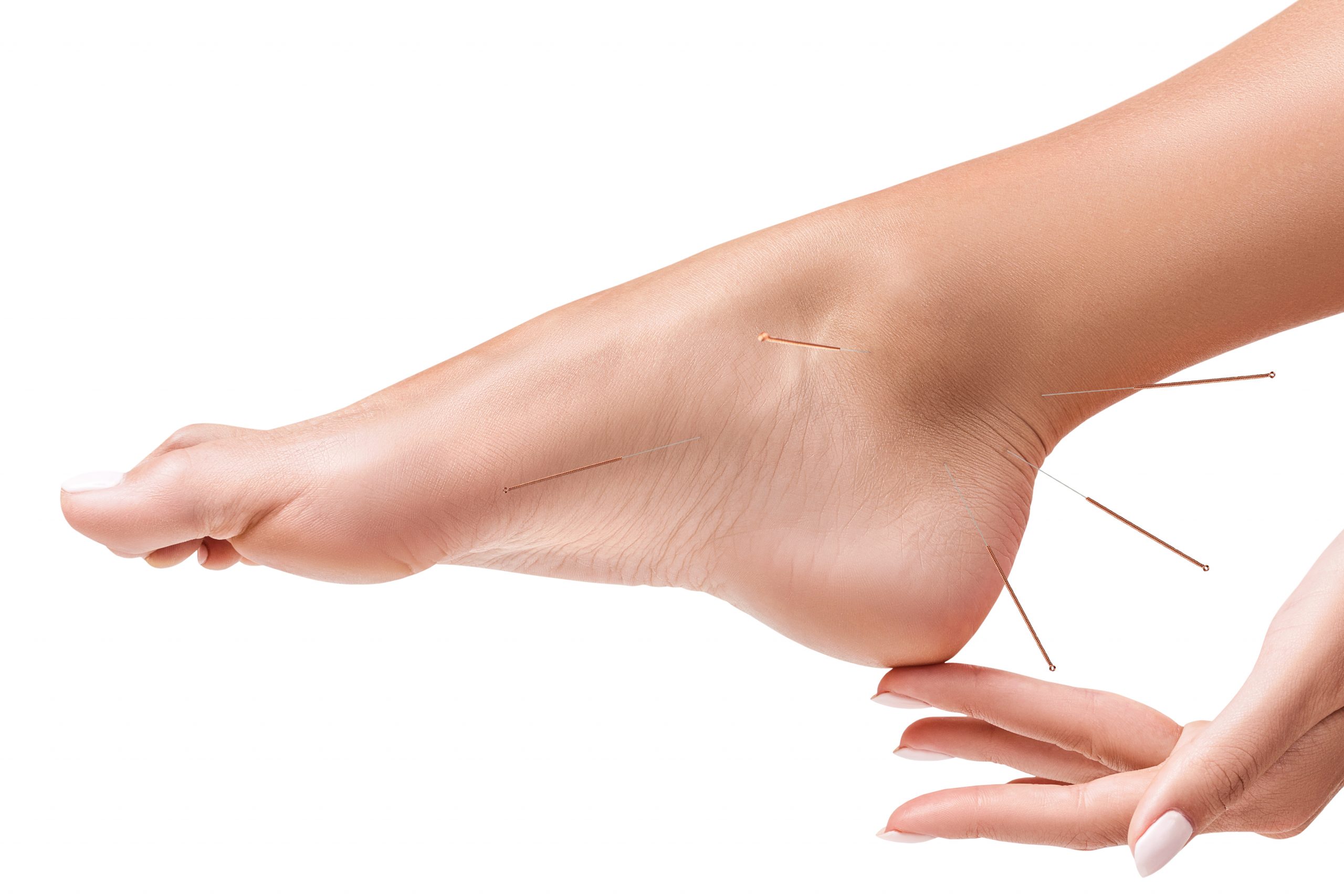 L'acupuncture, une alternative pour soulager une douleur aux pieds ...