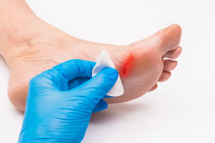 Image de :Pied diabétique : un podiatre pour le soigner