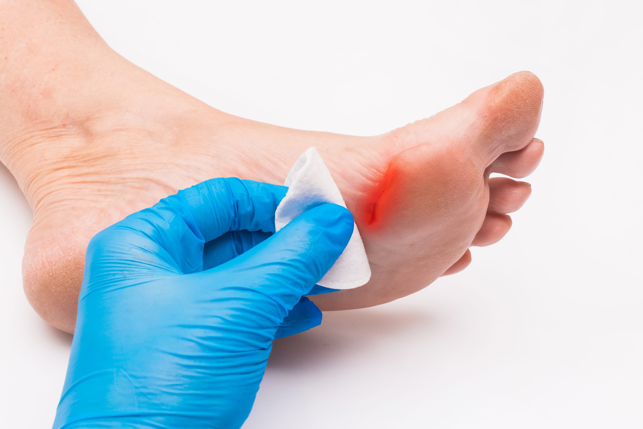 Can a podiatrist help you with diabetic foot care?