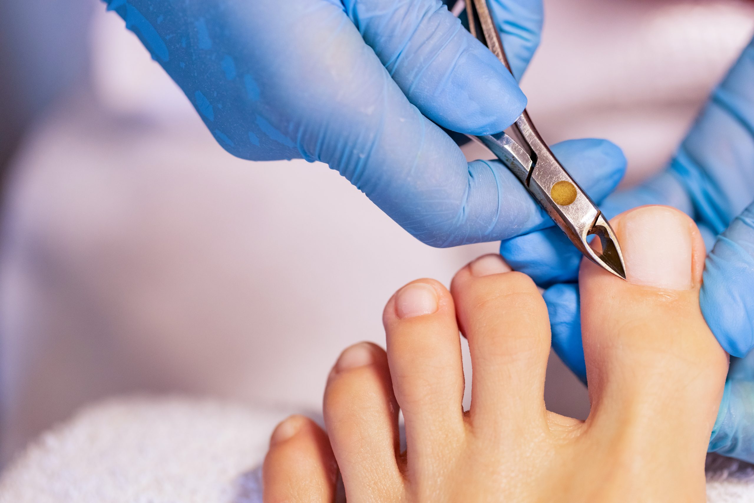Foot care in West Island