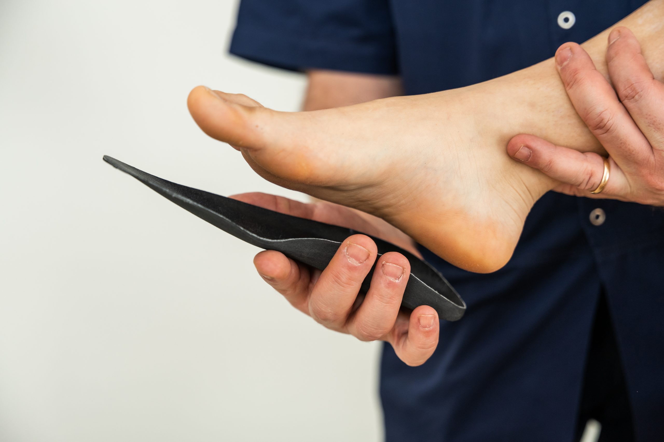 Freiberg’s disease: should you wear foot orthoses?
