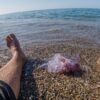 How to treat a jellyfish sting to the foot?