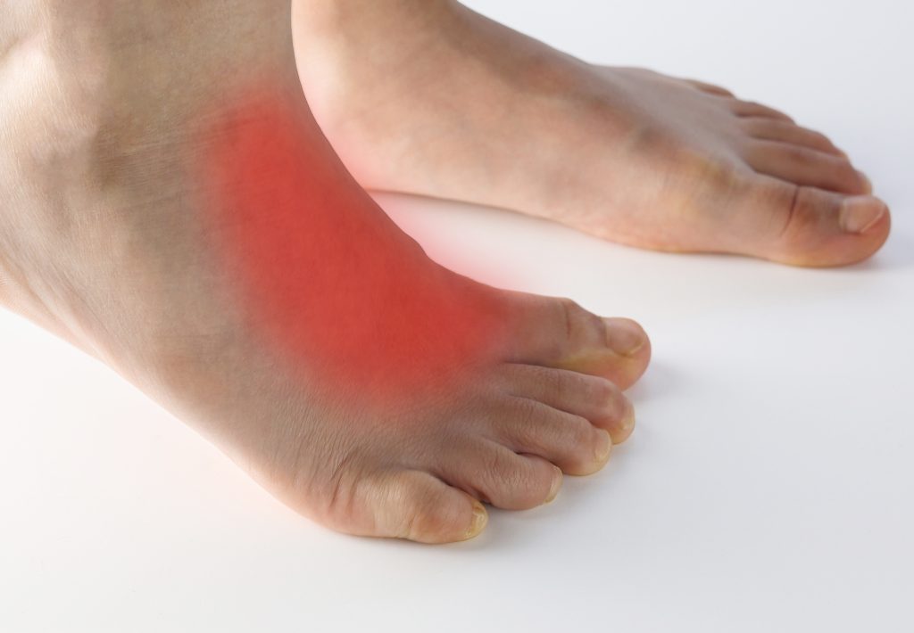 Les causes des douleurs sur le dessus du pied