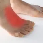 Douleurs sur le dessus du pied : les symptômes