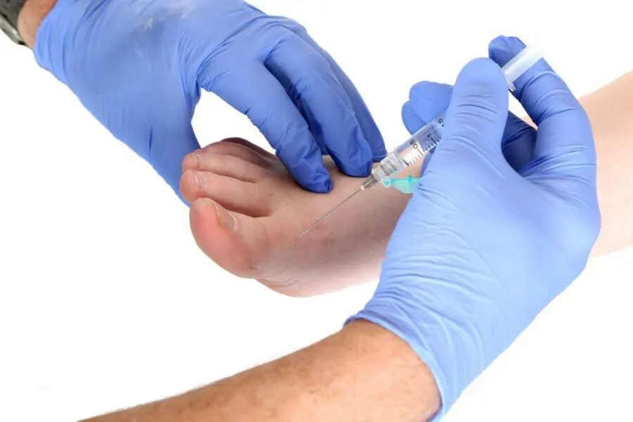Image de :L’injection de cortisone : quatre conditions qu’elle peut soigner