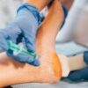 PRP (Platelet-Rich Plasma) Injection in the Foot for Plantar Fasciitis and Tendinitis