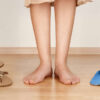Orthotics in Summer: Can You Wear Them with Sandals?