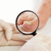 Molecular analysis for diagnosing onychomycosis