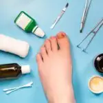 Quand choisir la chirurgie pour un ongle incarné