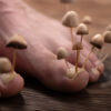 Champignons du pied : les différents types d’infections fongiques expliqués