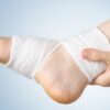 Soft tissue excision or foreign body surgery on the foot