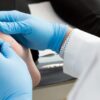 Foot care – Nails, corns and calluses treatment
