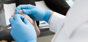 Image de :Foot care – Nails, corns and calluses treatment