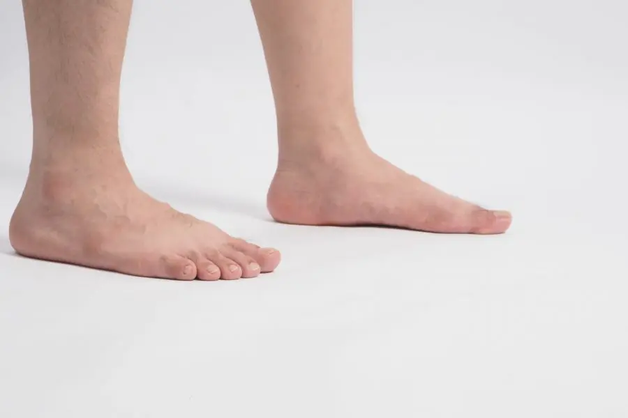 Pied Plat Causes Symptomes Et Traitements Piedreseau Pied Plat Causes Symptomes Et Traitements Piedreseau