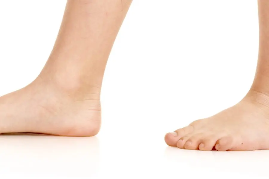 Comment reconnaître un pied plat chez l’enfant ?