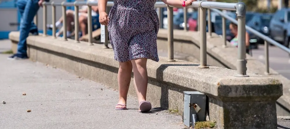 Genou Valgum Cause Symptome Et Traitement Piedreseau Genou Valgum Cause Symptome Et Traitement Piedreseau