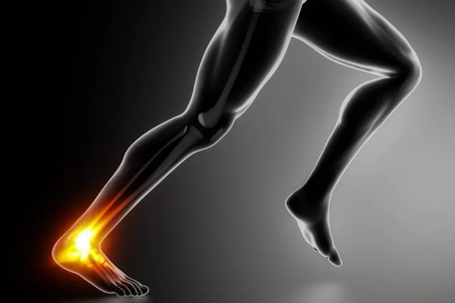 Treating Achilles tendonitis in 5 steps