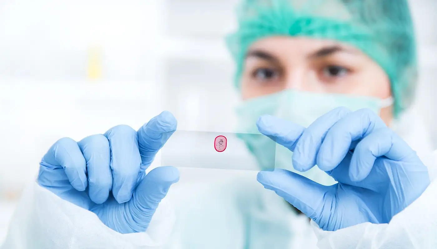Biopsie