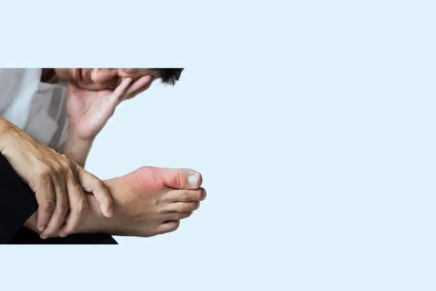 Hallux valgus surgery (bunion)